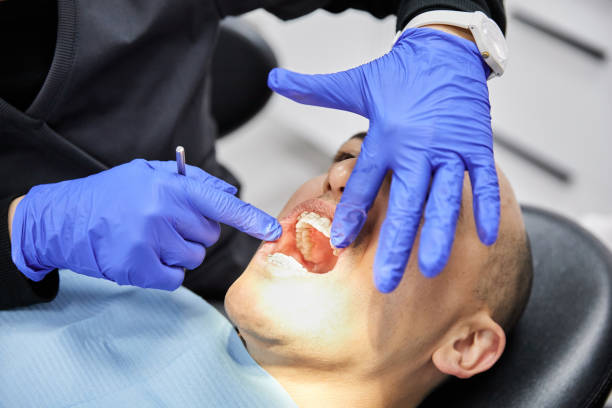 Best Emergency Dentist for Lost Fillings or Crowns in Franklin, TN