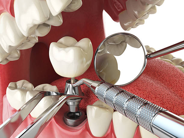 Best Broken or Cracked Tooth Emergency Dentist in Franklin, TN
